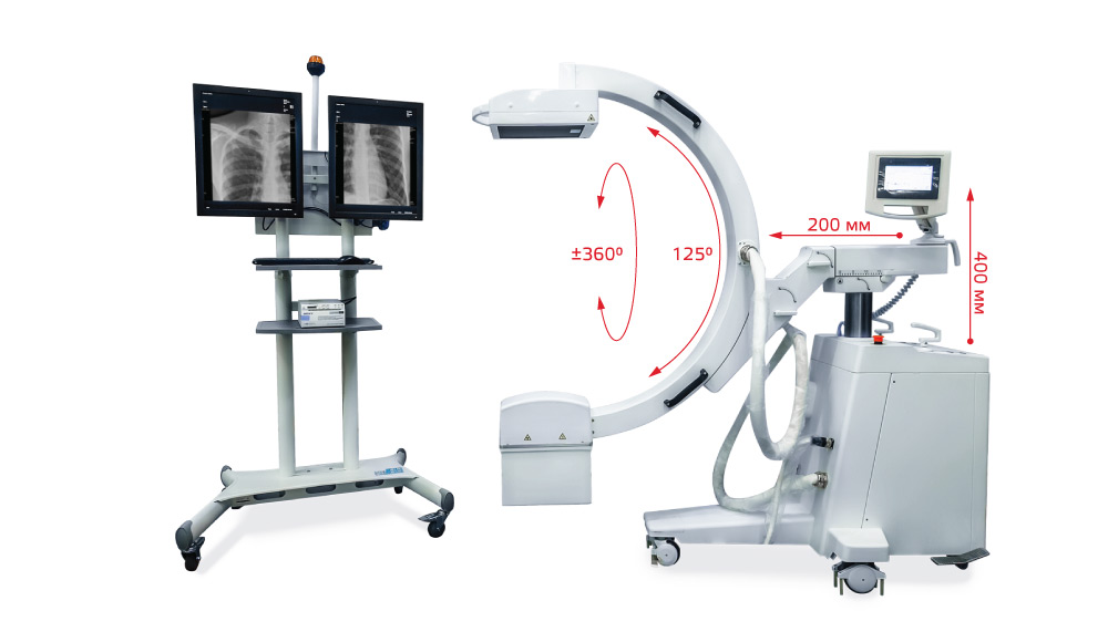 Аппарат рентгенохирургический передвижной АРХП-АМИКО